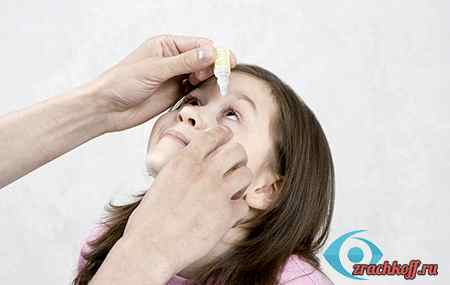 Аллергический конъюнктивит капли для детей
