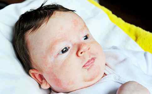 Диагностика аллергии у детей с какого возраста