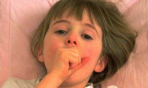 Глухой кашель у ребенка чем лечить