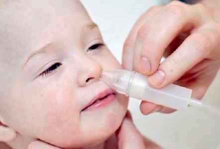 Промывание носоглотки при аденоидах у детей