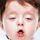 Сухой горловой кашель у ребенка ингаляции