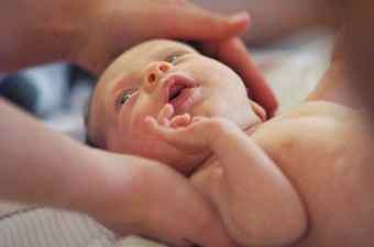 Синдром желтухи у новорожденных детей