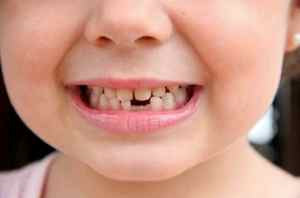 Постоянный зуб у ребенка выпал