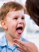 У ребенка почернел язык после антибиотиков