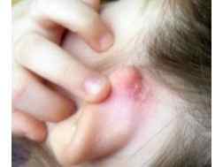 Как лечить золотуху за ушами у детей
