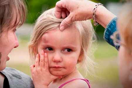 Как определить сотрясение мозга у ребенка 1 год