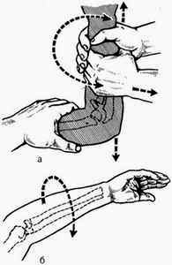 Перелом лучевой кости у детей лечение