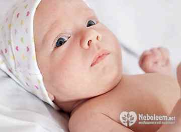 Синяк на голове у ребенка после родов