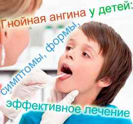 Лечение гнойной ангины у детей антибиотиками