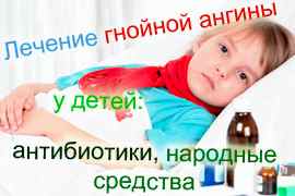 Лечение гнойной ангины у детей антибиотиками