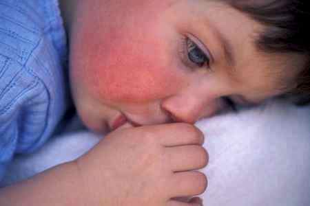 Почему у ребенка красное горло и высокая температура