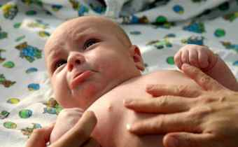 Пиелоэктазия у грудного ребенка комаровский