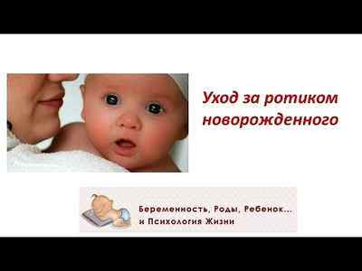 Молочница на языке у ребенка 1 год