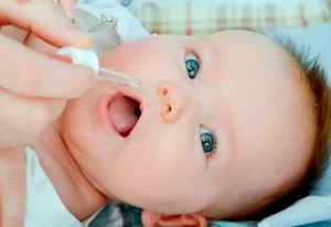 Молочница на языке у ребенка 1 год
