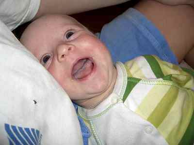Молочница у ребенка 2 месяца фото