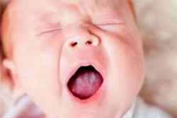 Молочница во рту ребенка лечение