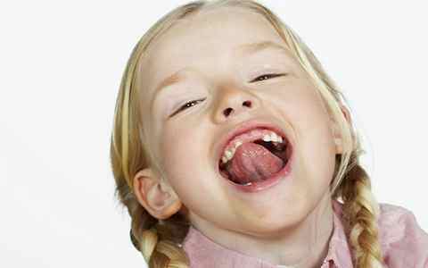 Подрезать уздечку языка ребенку цена красноярск
