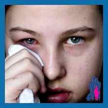 Почему гноятся глаза у ребенка при простуде