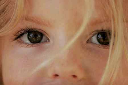Почему у ребенка синяки вокруг глаз