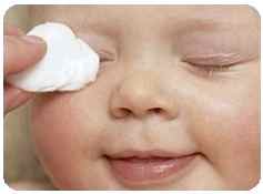 Почему у ребенка закисают глаза комаровский