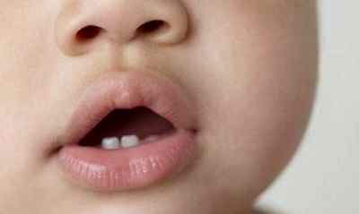 Прорезывание глазных зубов у детей комаровский