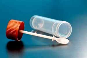 Как определить глисты у ребенка по анализу крови