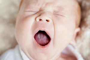 Белый налет на языке у месячного ребенка