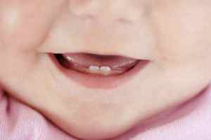 График прорезывания зубов у детей шаблоны