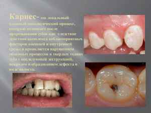 Классификация кариеса зубов у детей по степени активности