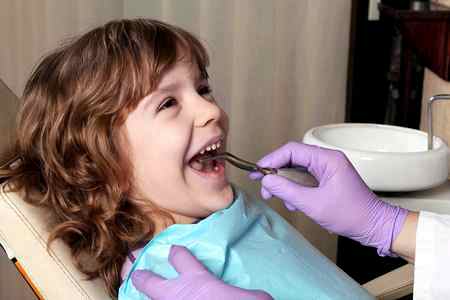 Лечение кариеса передних зубов у детей