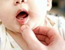 Режутся зубки как помочь ребенку какой гель лучше