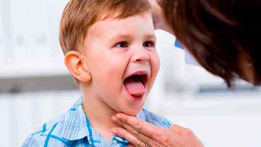 Желтый язык у ребенка 2 года