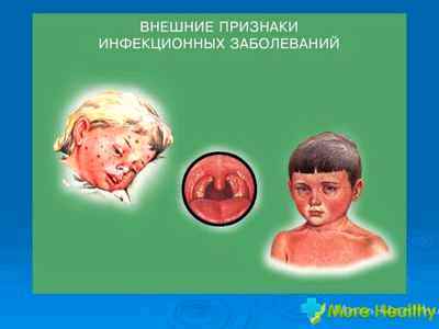 Профилактика вирусных инфекций у детей памятка