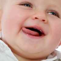 Глоссит у ребенка 3 месяца