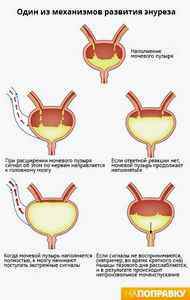 Причины недержания мочи у детей 8 лет