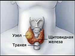 У ребенка уменьшена щитовидная железа