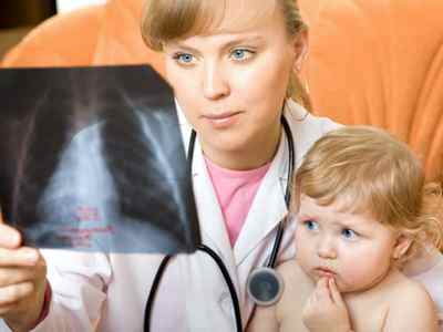Пневмония у годовалого ребенка симптомы