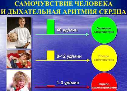 Синусовая аритмия у детей 9 лет