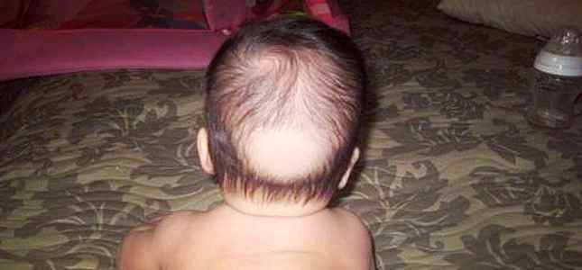 У месячного ребенка выпадают волосы