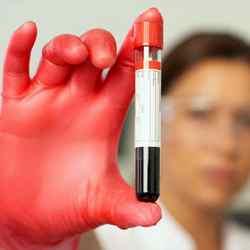 Цирроз печени у детей анализ крови